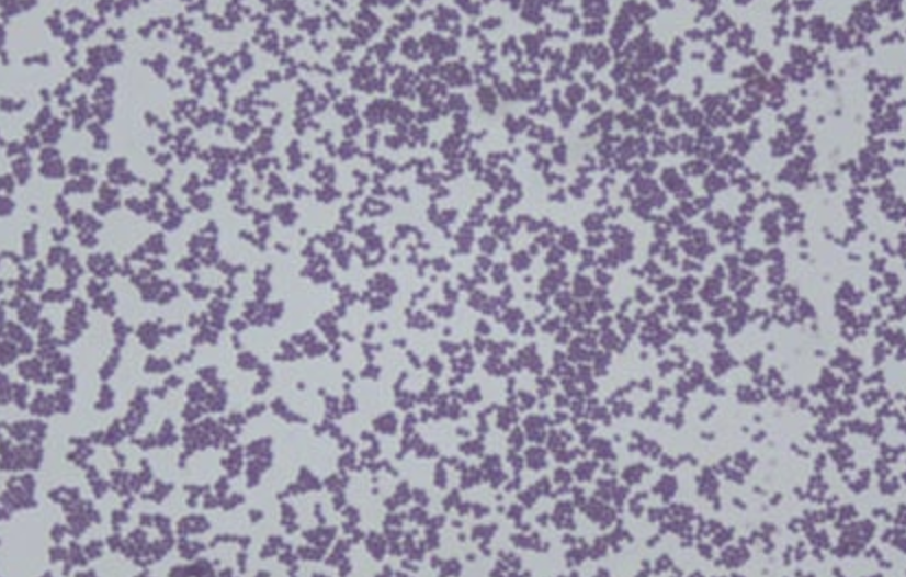 The Use of Bacteriophage K as a Disinfectant of S. epidermidis in Spaceflight